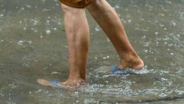 Des pieds marchant dans l'eau d'inondation, illustrant le risque de leptospirose et les défis sanitaires post-inondation.