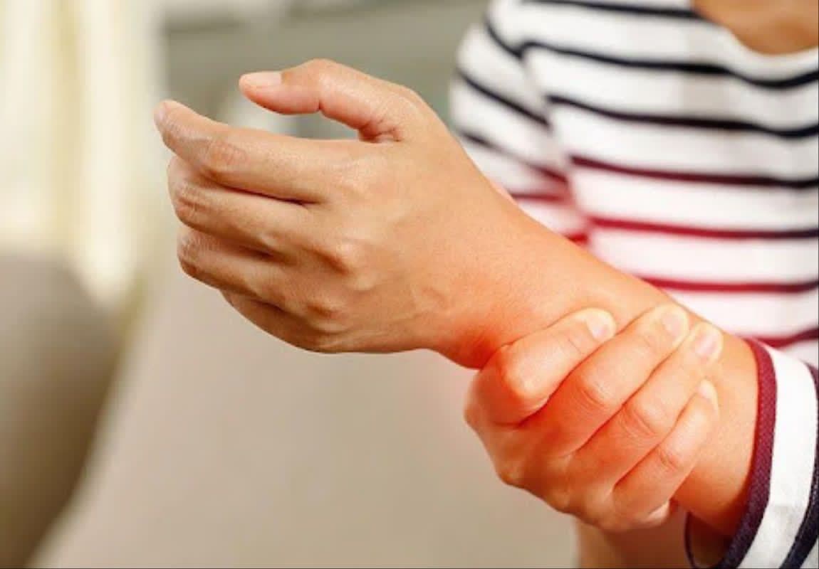 Une personne se tenant le poignet, symbolisant la douleur articulaire intense et la raideur causées par le Chikungunya.